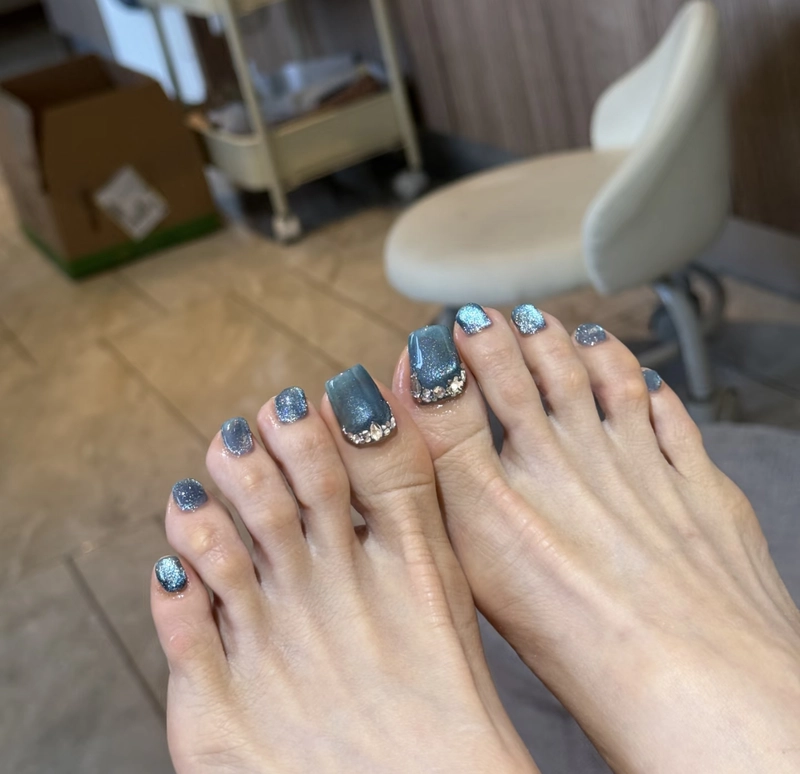 nail chân đính đá ngón cái